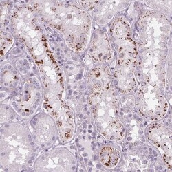 SAMD5 Antibody, Novus Biologicals:Antibodies:Primary Antibodies